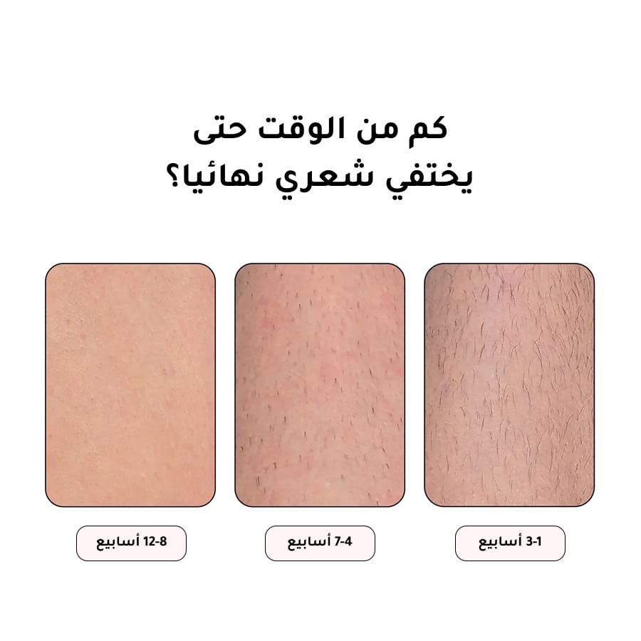 جهاز إزالة الشعر IPL Pro Original